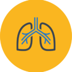 Chronic-pulmonary-aspergillosis